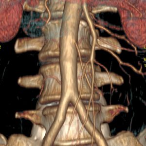 Abdominalarterien CT-Angiographie o.B.