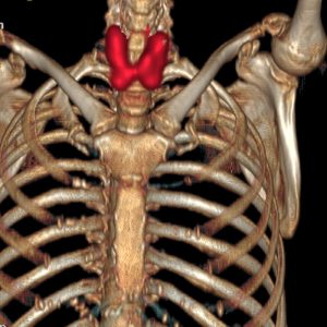M. Basedow FDG-PET/CT-VR